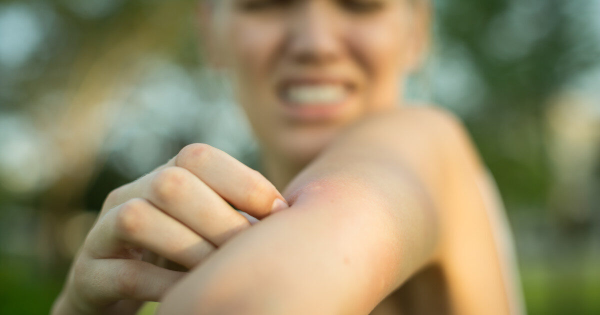 Malaria ucide angajați aeroport din Germania: Țânțarii au venit cu avionul