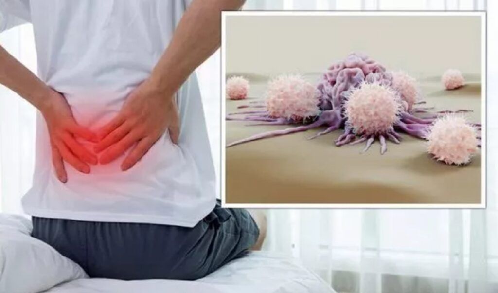 Cancer „tăcut”: 5 simptome banale care te trimit la medic
