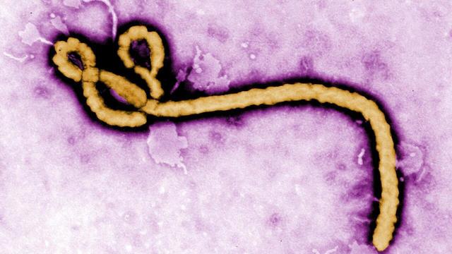 Ebola, mutație letală în Congo?