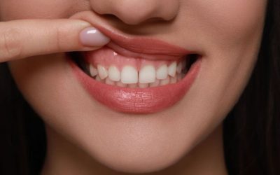 Semn din gură: Nu e doar estetic, ascunde boli grave