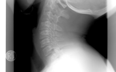 Spitalul Bihor: AI ajută medicii la radiologii de urgență