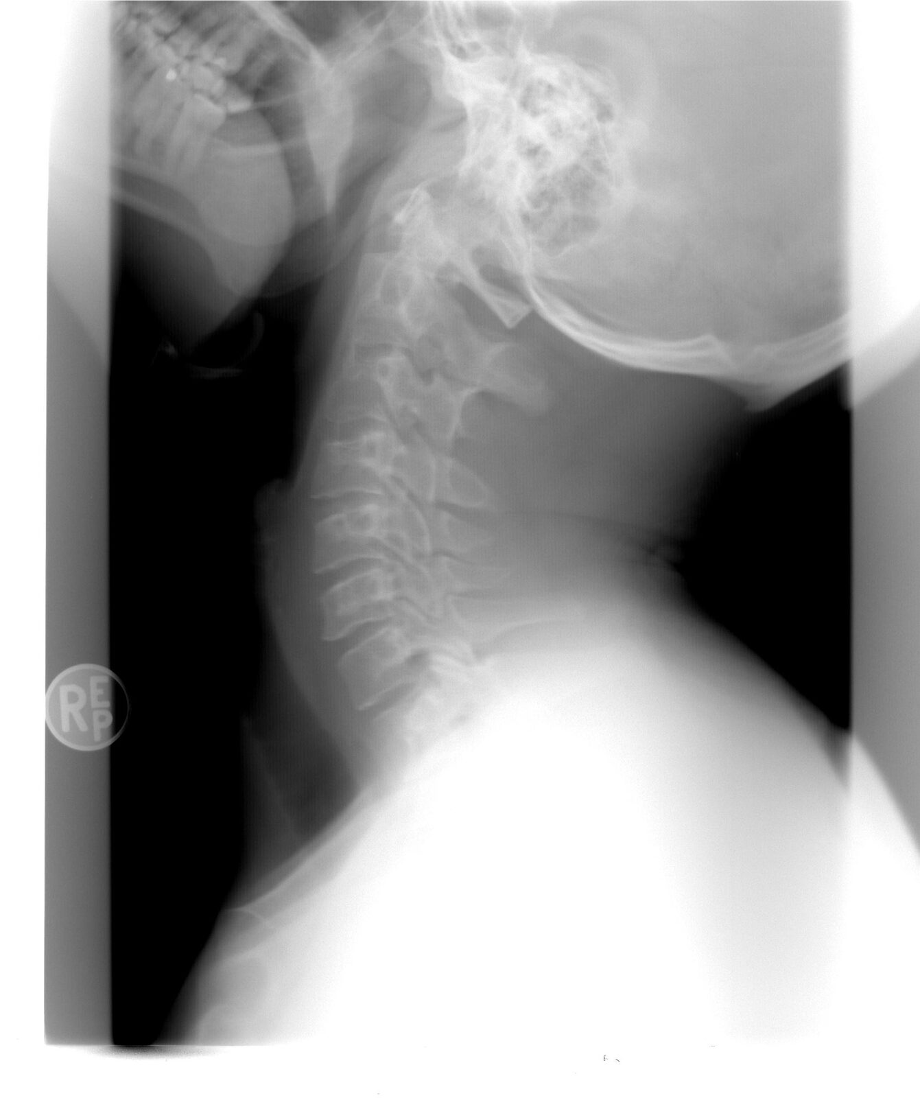 Spitalul Bihor: AI ajută medicii la radiologii de urgență