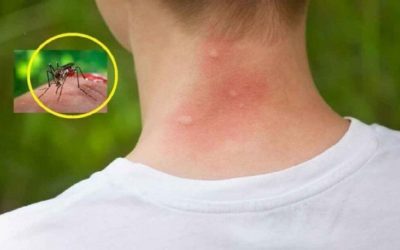 Țânțarii te aleg: 3 bacterii secrete!