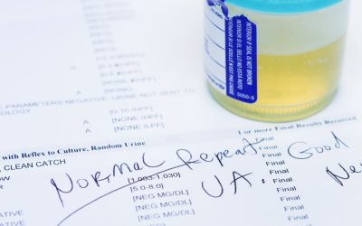 Test urină: 9 din 10 cancere de vezică depistate